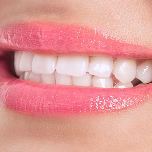 Dental Hygiene Maplewood